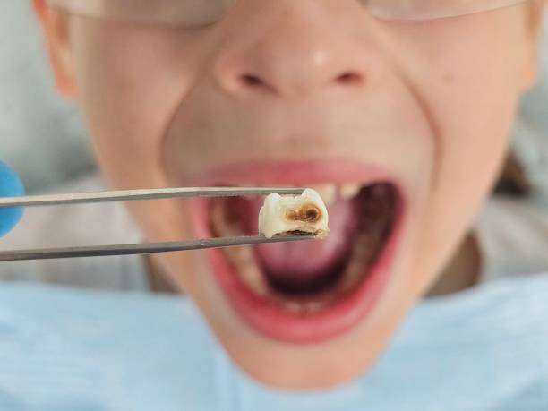Best Weekend Emergency Dentist in Walters, OK